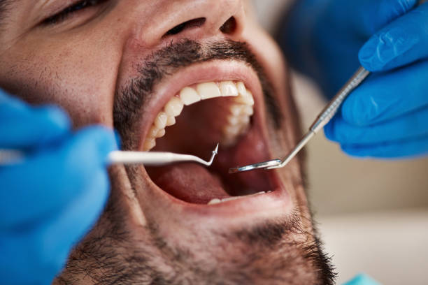 Best Emergency Dental Care for Sports Injuries in Fabens, TX